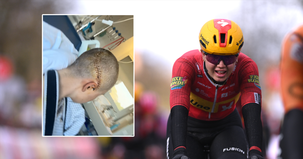 Noors wielertalent (19) toont heftige beelden na akelige val in Parijs-Roubaix: 'Ik heb veel pech gehad'